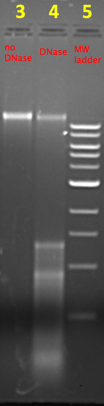 student results: DNA isolation and gel electrophoresis