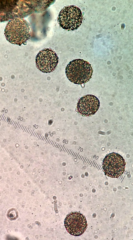 Maple pollen on a microscope slide