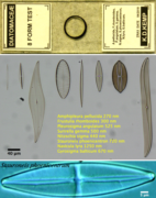 A slide of assorted diatoms used for microscope resolution tests
