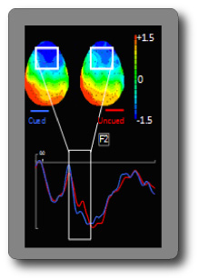 Electro-encephalograph data