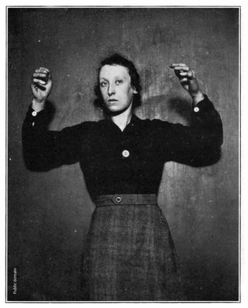 post-1918 pandemic encephalitis patient with arms raised