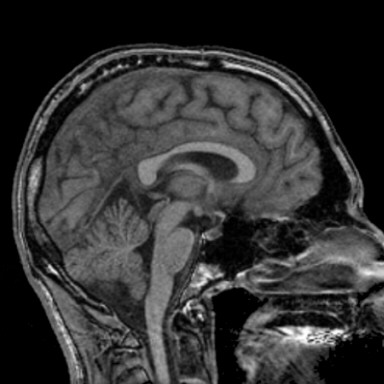 saggital view of my brain