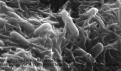 nanowires connecting bacteria