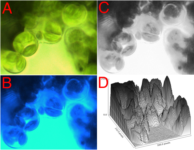 Leaf chloroplasts visualized under white and blue light, and quantified