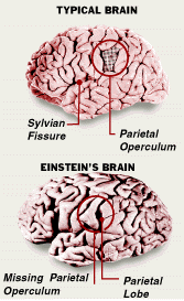 Typical Brain