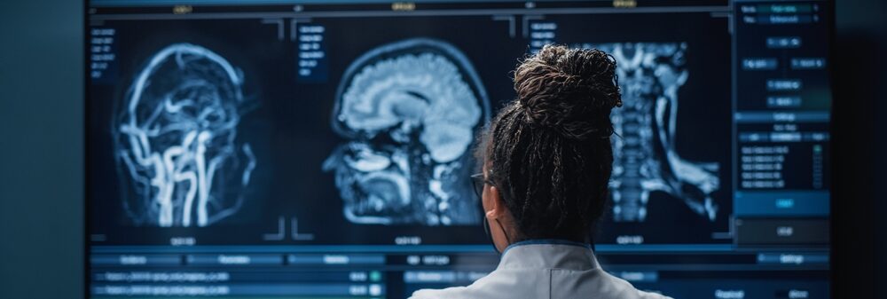 Doctor looking at an MRI image of a brain