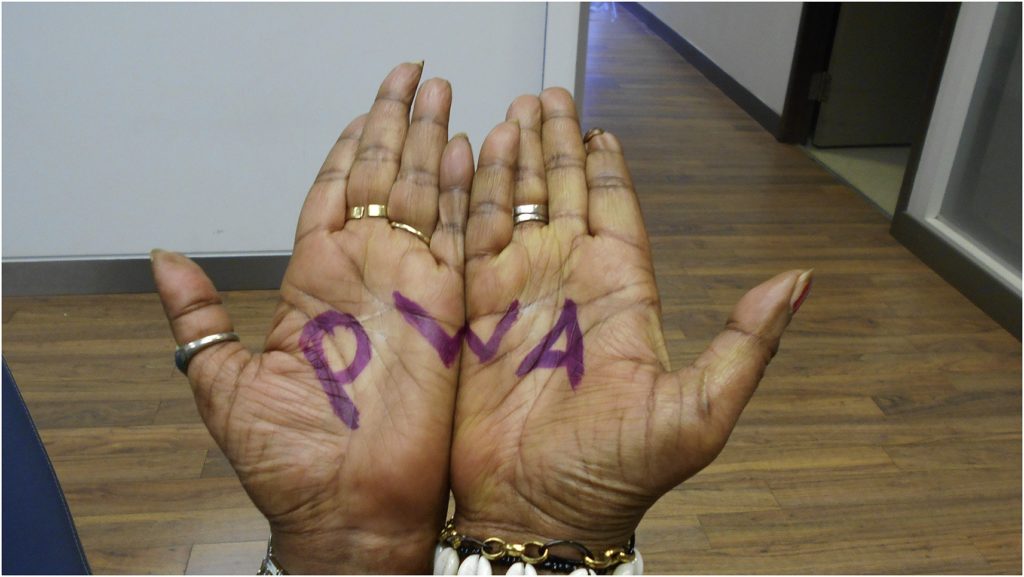 hands with PWA written on palms