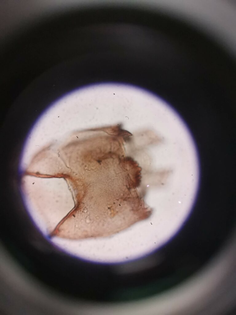 Microscope view of a subfossil chironomid head capsule.