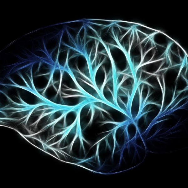 York research shows AI better than human eye at predicting brain metastasis outcomes